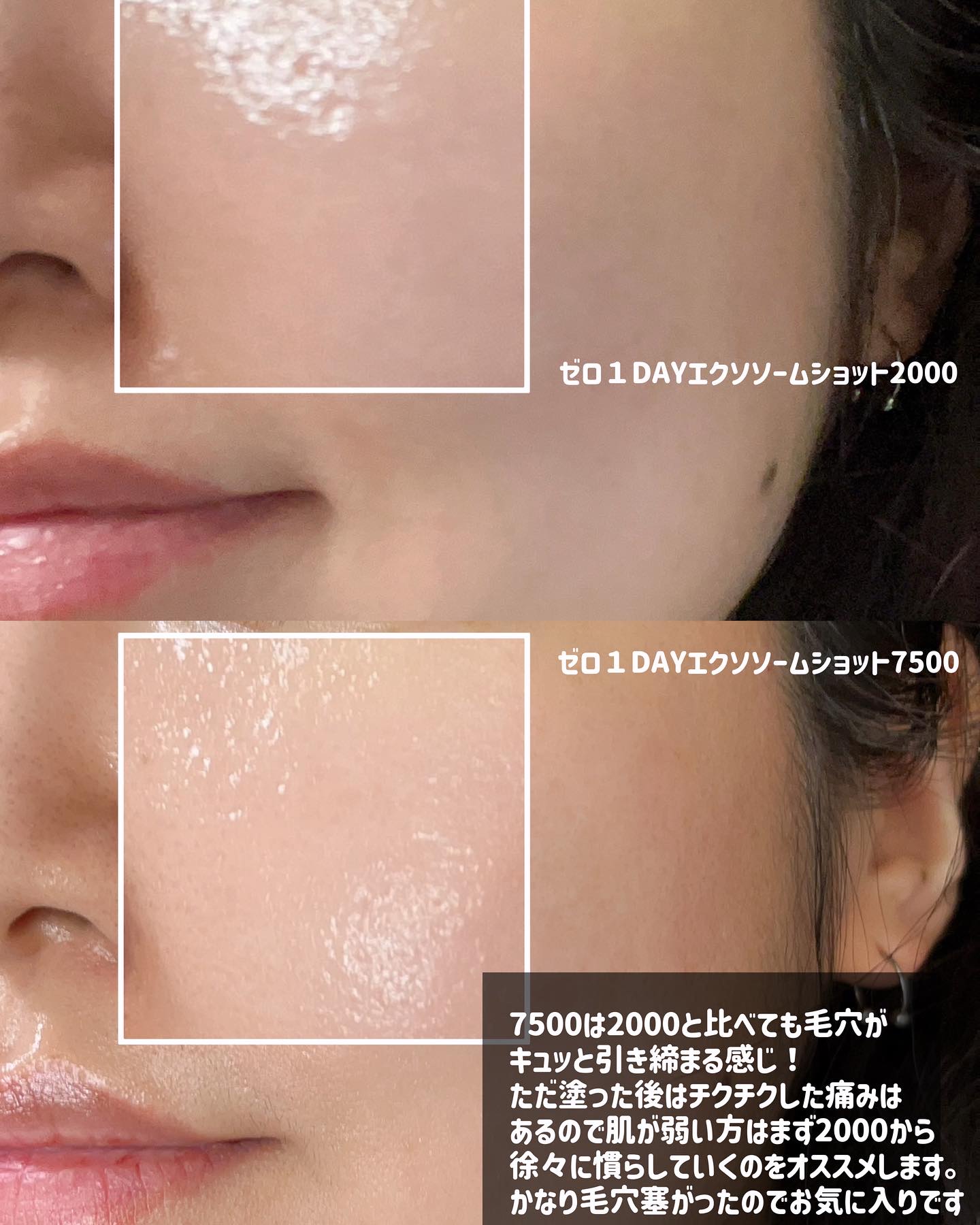 ゼロ1DAYエクソソームショット2000｜MEDICUBEの使い方を徹底解説