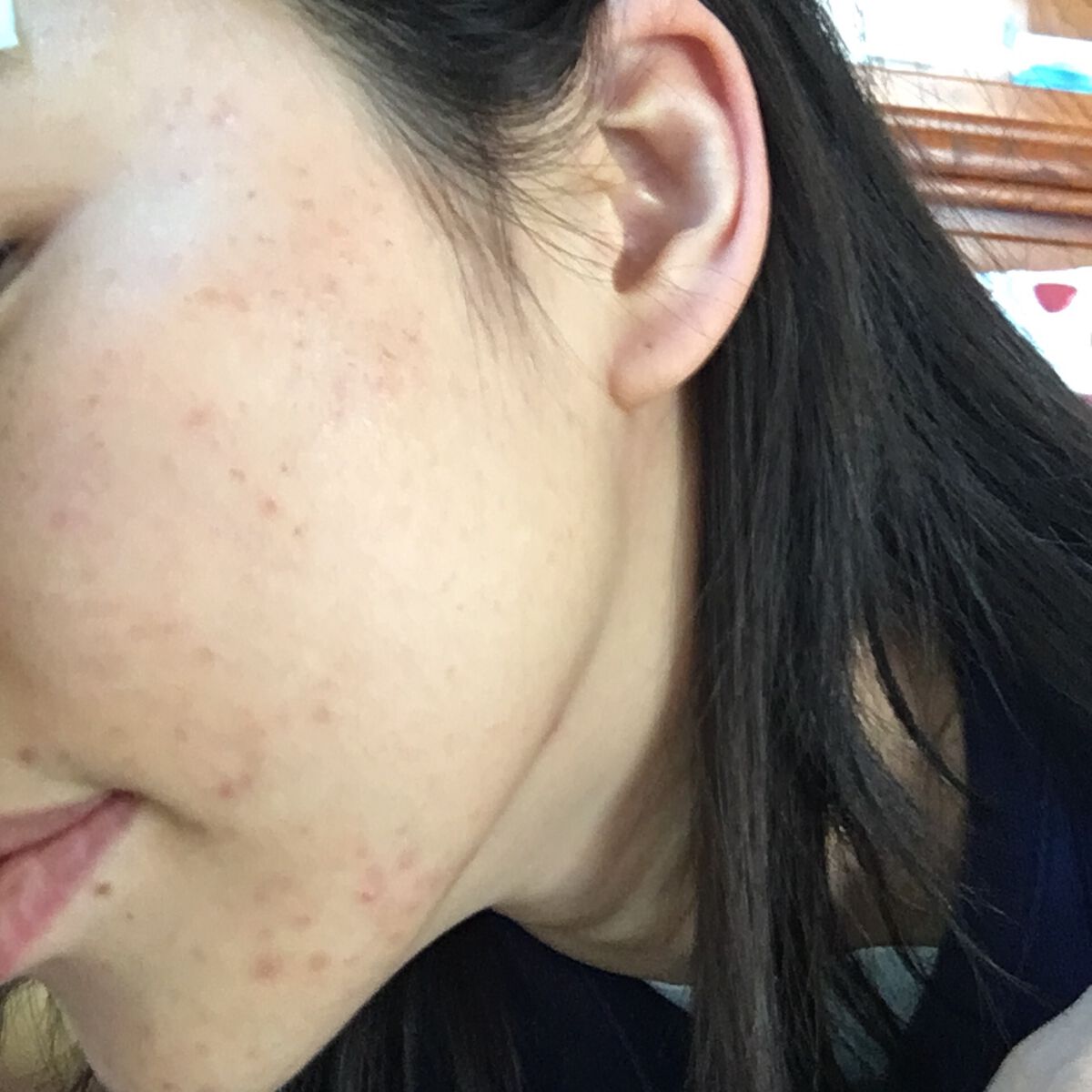 マイクラランス ピュア クレンジング ジェル/CLARINS/クレンジングジェルを使ったクチコミ（2枚目）