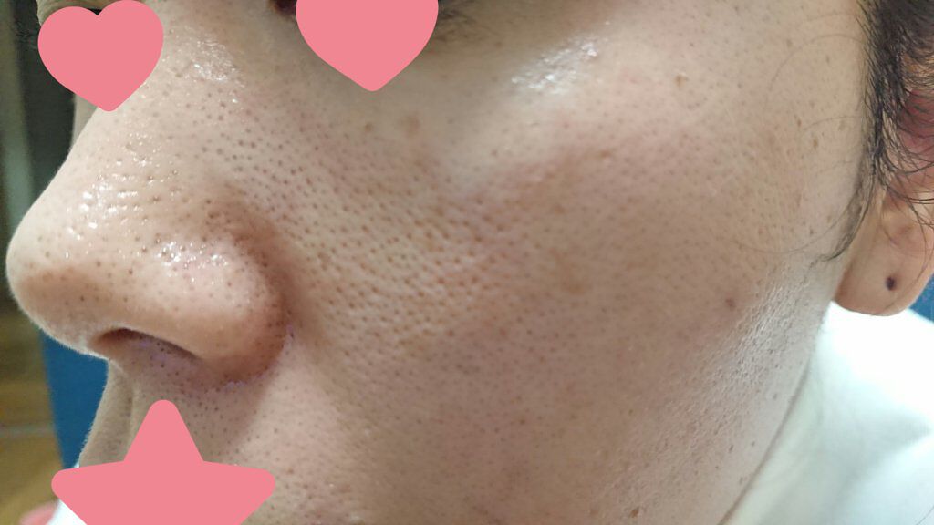 ロゼット洗顔パスタ 海泥スムース/ロゼット/洗顔フォームを使ったクチコミ(3枚目)