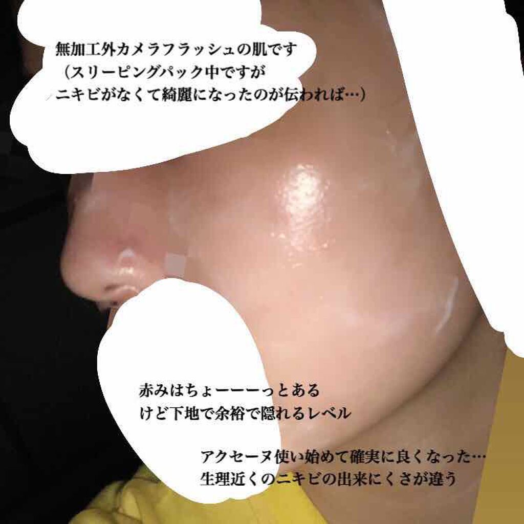 モイストバランス  ローション/ACSEINE/化粧水を使ったクチコミ（3枚目）