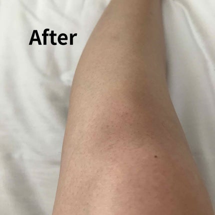 除毛クリーム ジャスミンハニー/スリンキータッチ セルフスパ/除毛クリームを使ったクチコミ(4枚目)