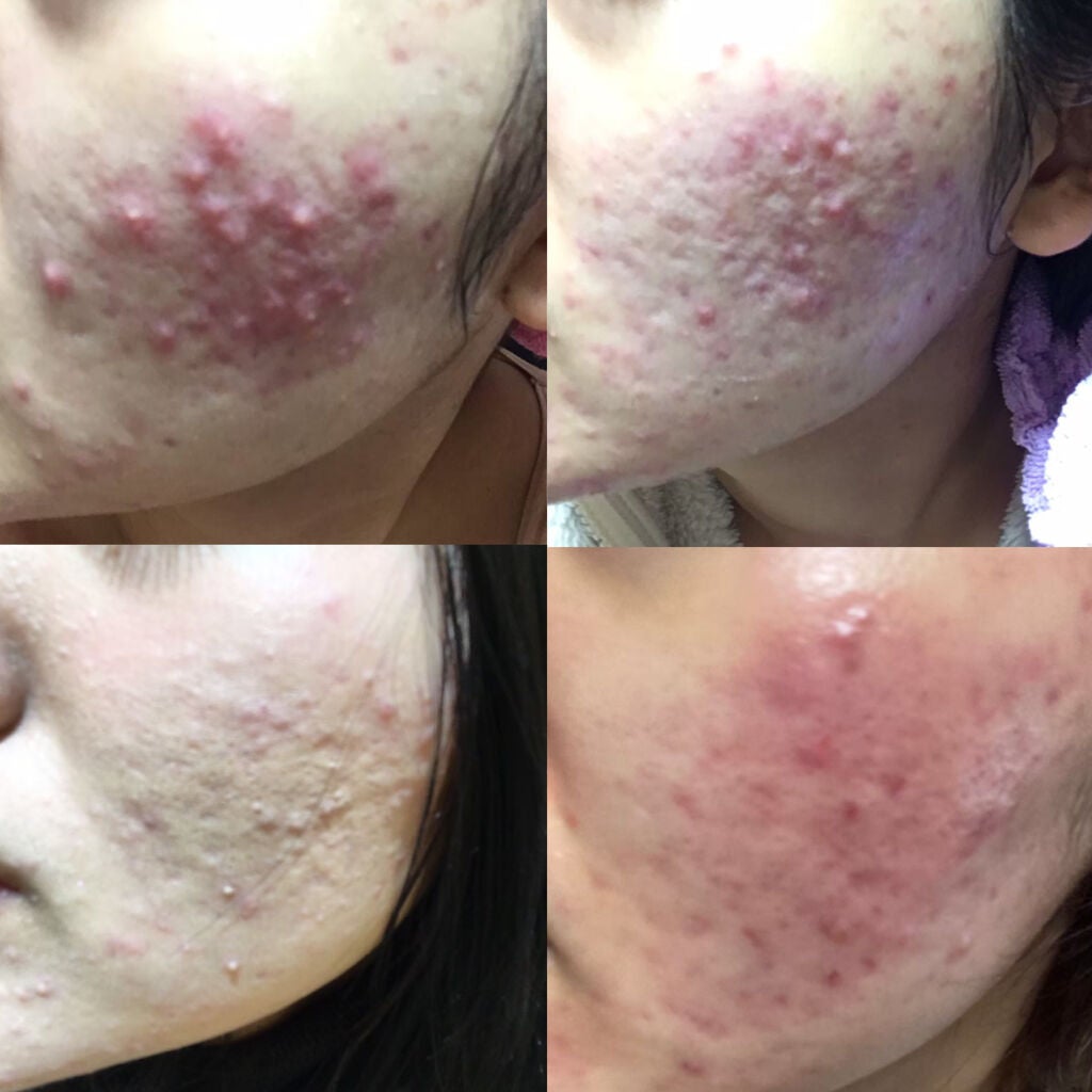 ザ・タイムR アクア/IPSA/化粧水を使ったクチコミ(2枚目)