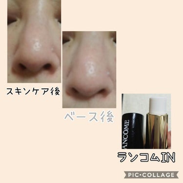 タンイドル ウルトラ ウェア ブラー /LANCOME/スティックコンシーラーを使ったクチコミ（3枚目）