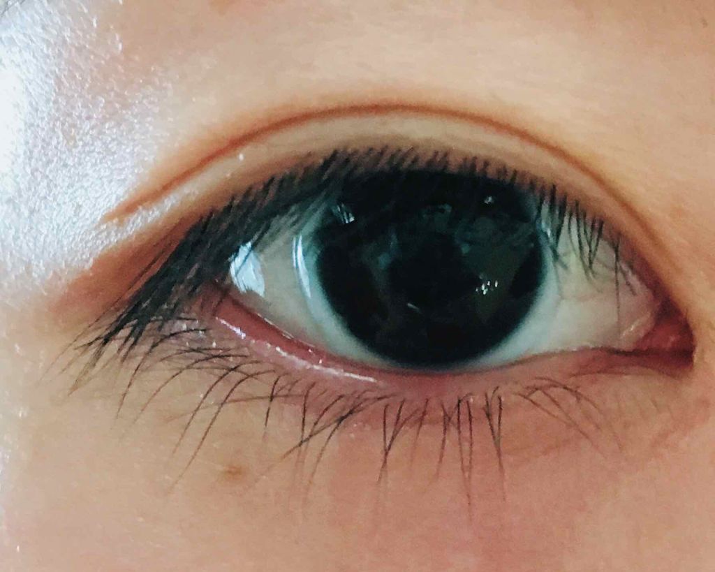 ハイブリッドフィルム/アイトーク/二重まぶた用アイテムを使ったクチコミ(2枚目)