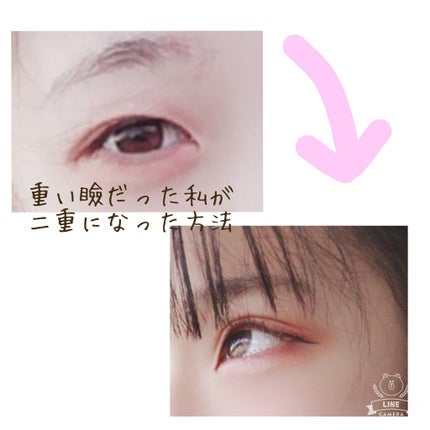 アイトーク/アイトーク/二重まぶた用アイテムを使ったクチコミ(1枚目)