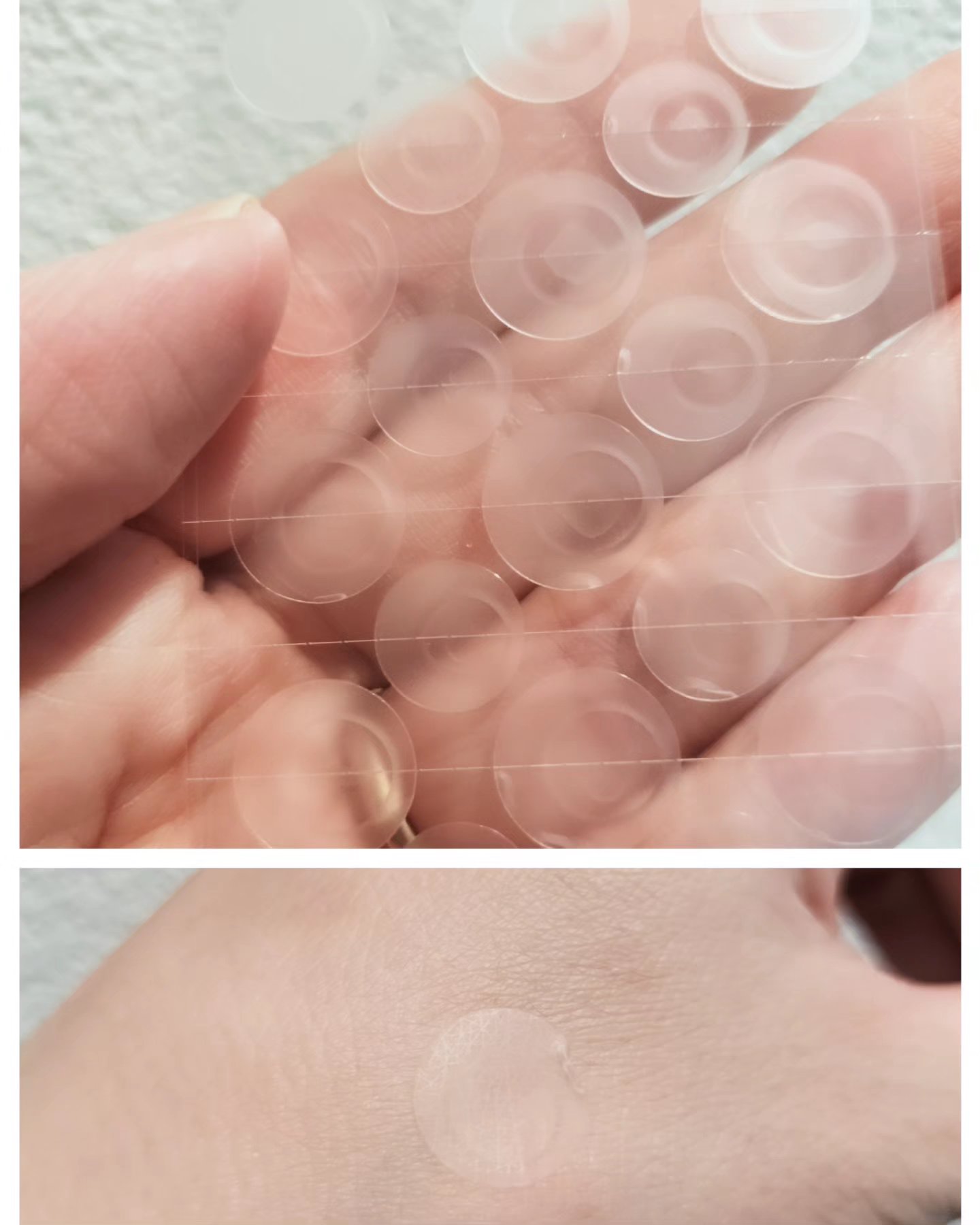 FATION ノスカナイン スポット パッチのクチコミ「♚FATION ノスカナイン スポット パッチ♚

‎‪𓍯 ‬10mm×8枚、12mm×15枚.....」（2枚目）