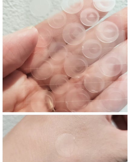 ノスカナイン スポット パッチ/FATION/にきびパッチを使ったクチコミ(2枚目)