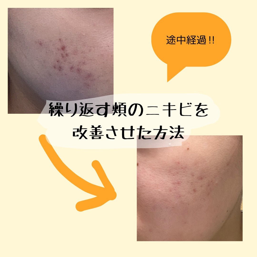 コラージュフルフル 泡石鹸/コラージュ/デリケートゾーンケアを使ったクチコミ(1枚目)