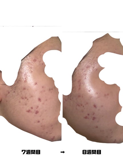 を使ったクチコミ(3枚目)