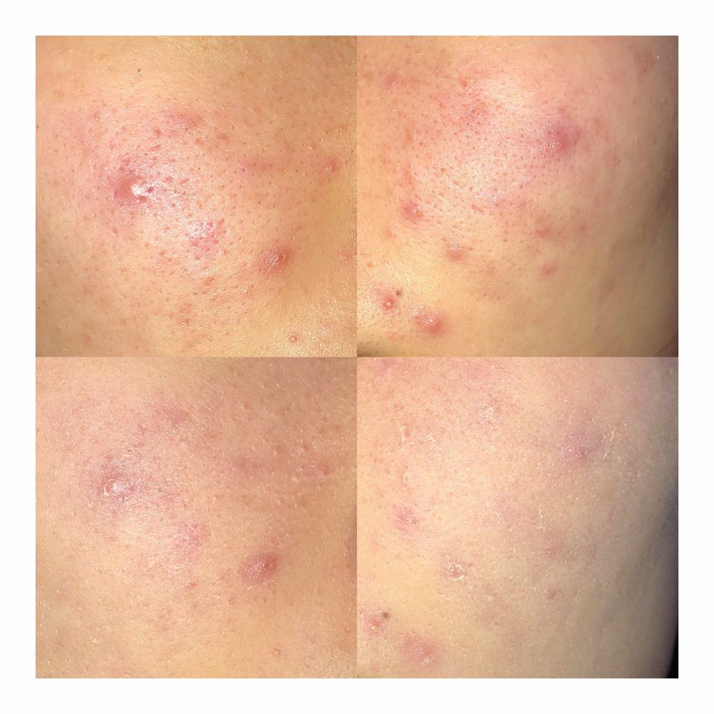 エテュセ ポアレスプライマー/ettusais/化粧下地を使ったクチコミ(1枚目)