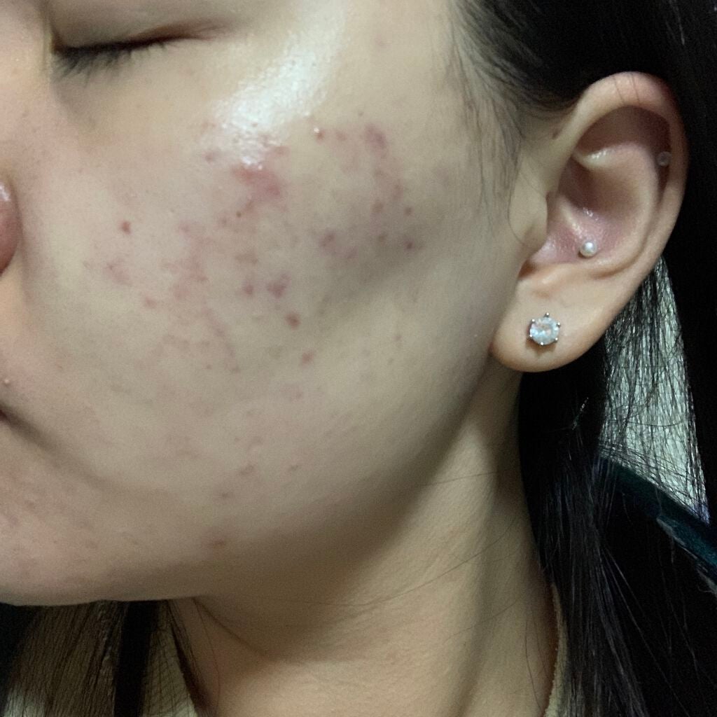 ティーツリーケア ソリューション エッセンシャルマスクEX/MEDIHEAL/シートマスク・パックを使ったクチコミ(2枚目)