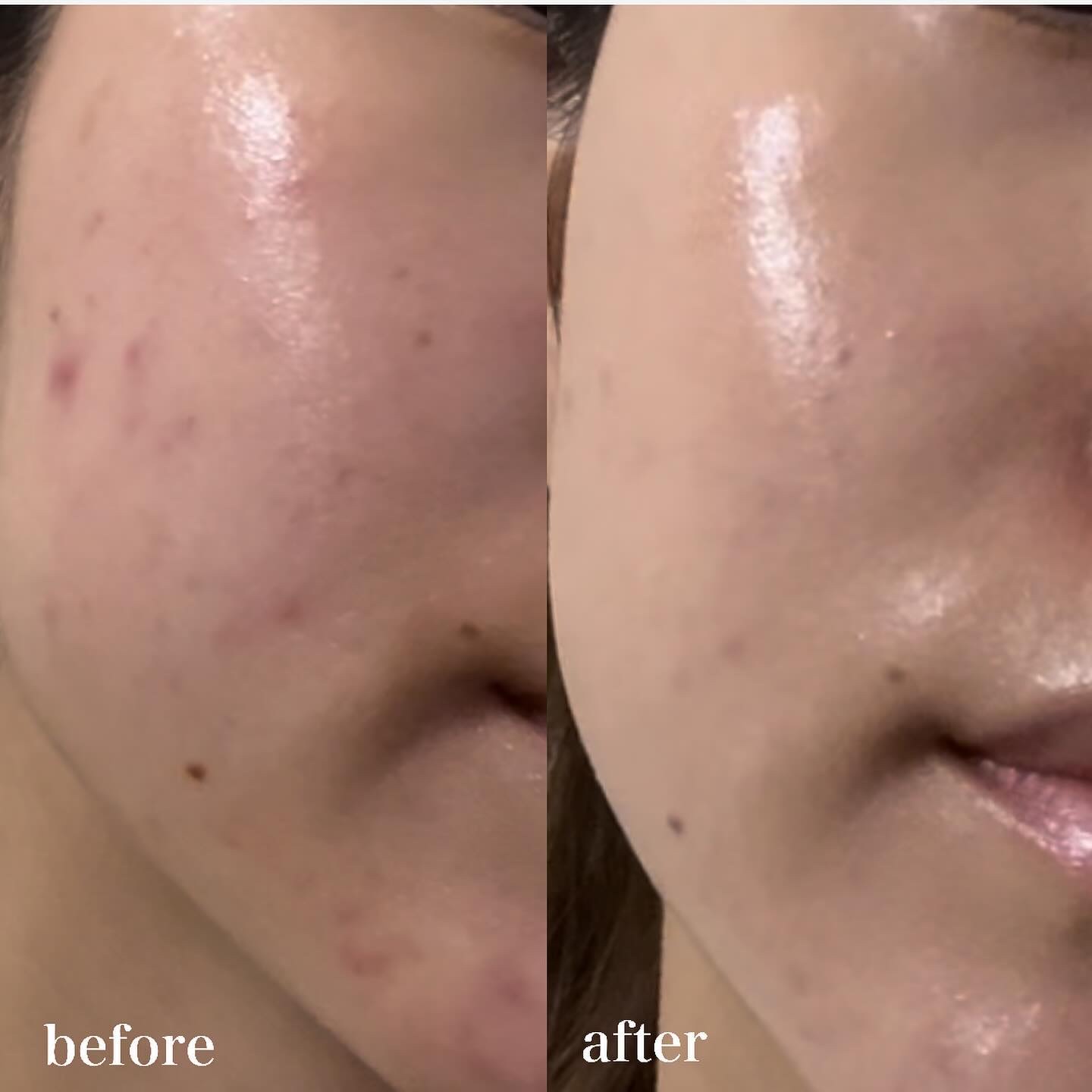 潤浸保湿 色づくベースミルク /キュレル/日焼け止めミルクを使ったクチコミ（2枚目）