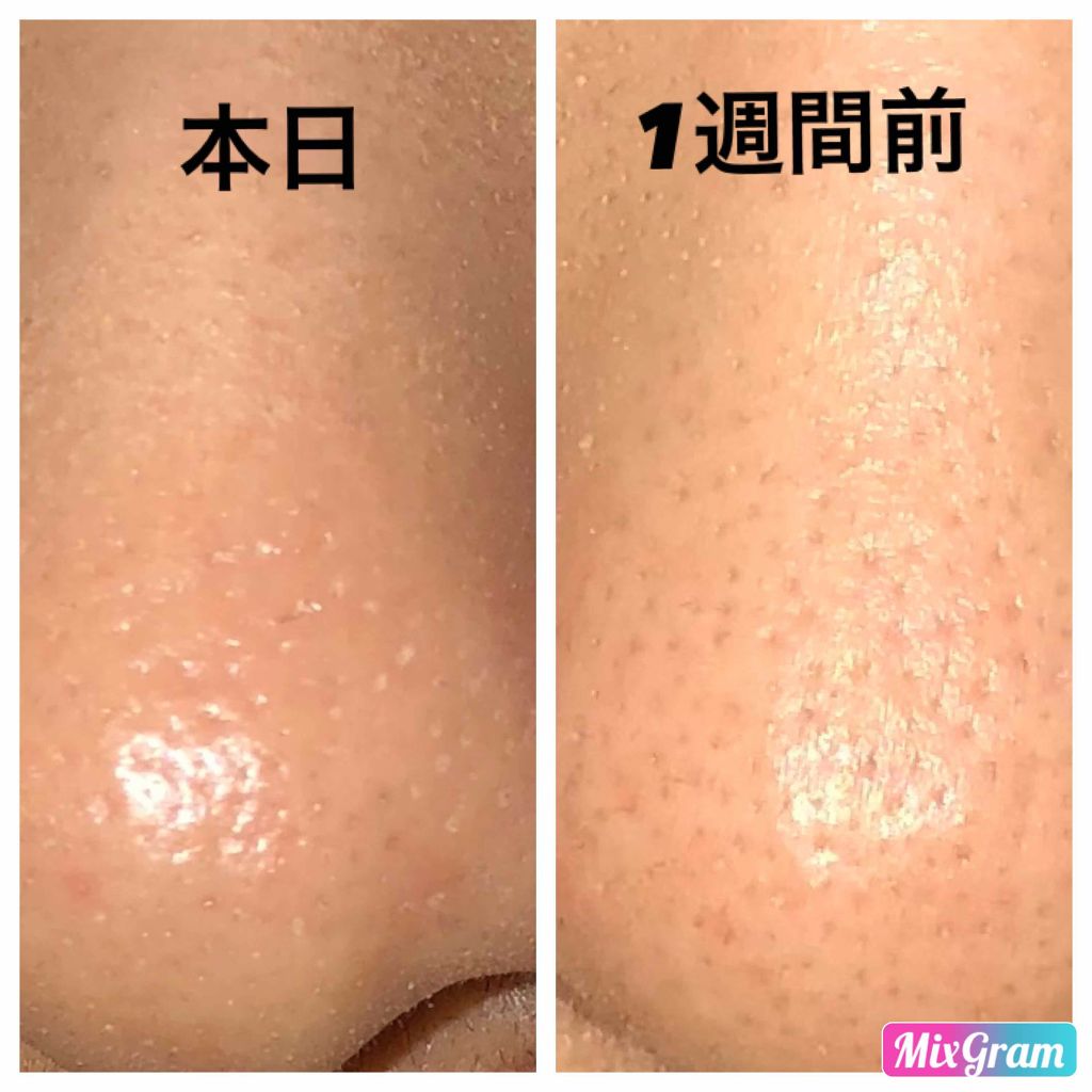 スキンミルク/ettusais/フェイスクリームを使ったクチコミ（2枚目）