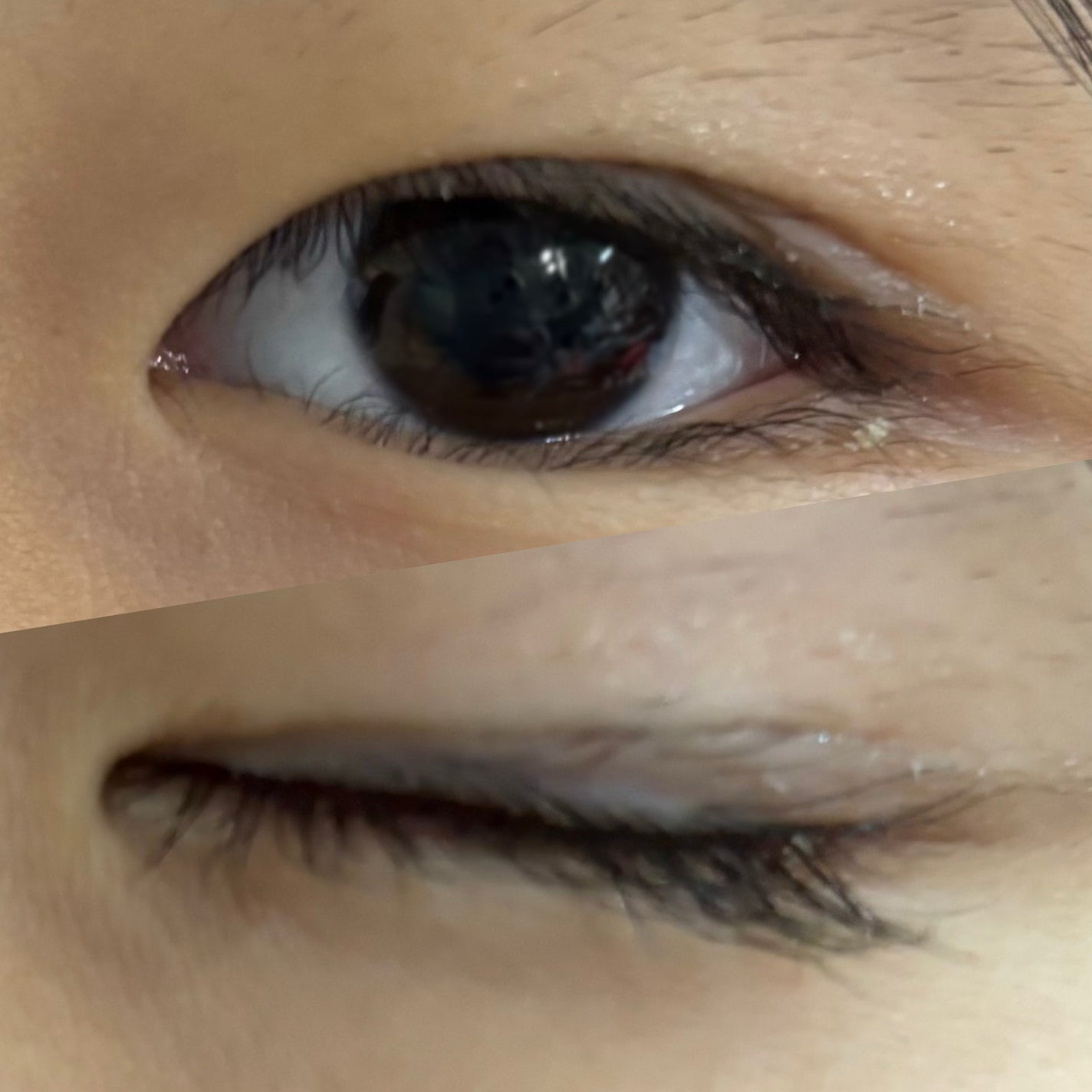 メザイク イージークリア 接着クリアタイプ/メザイク/二重まぶた用アイテムを使ったクチコミ(3枚目)