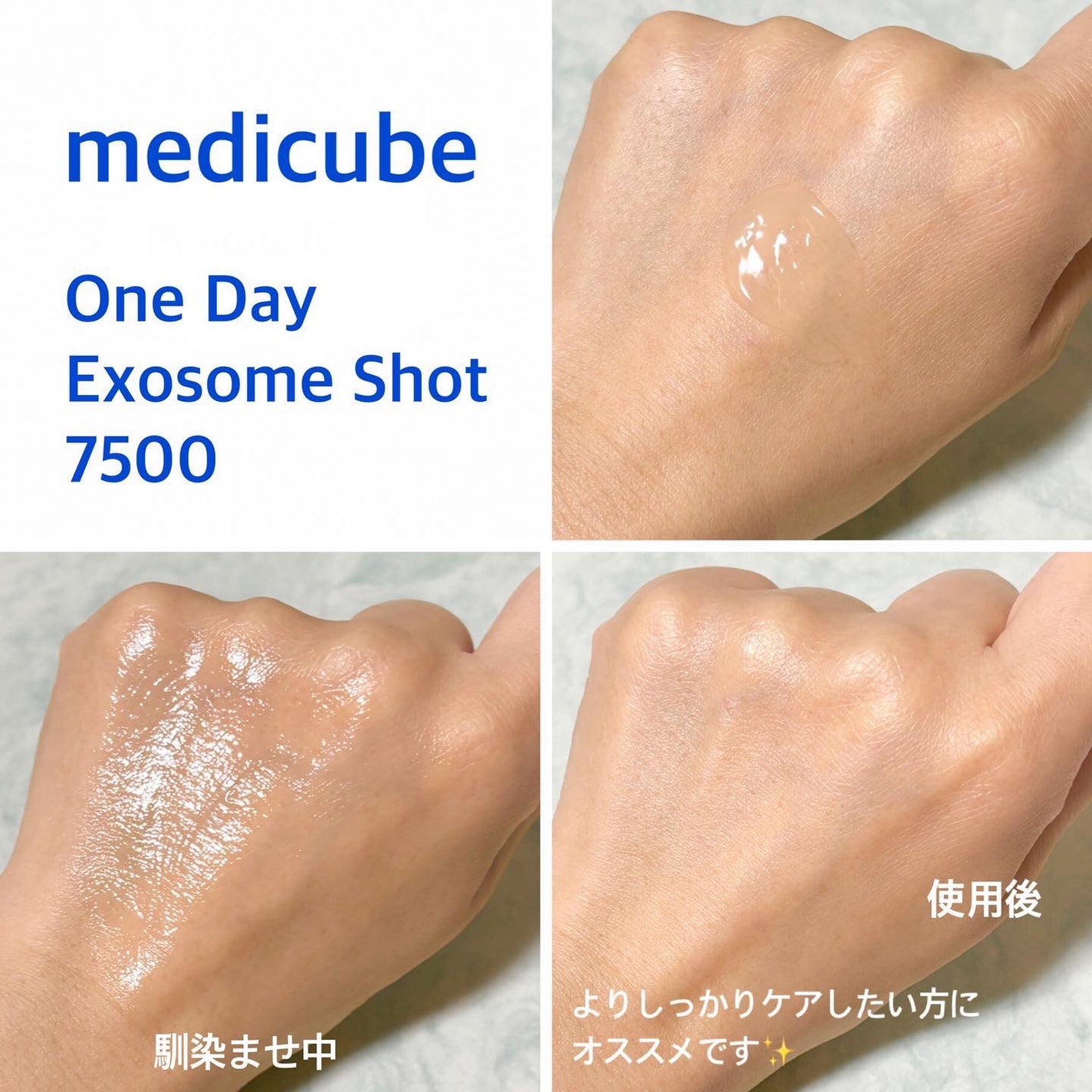 ゼロ1DAYエクソソームショット2000/MEDICUBE/美容液を使ったクチコミ(5枚目)