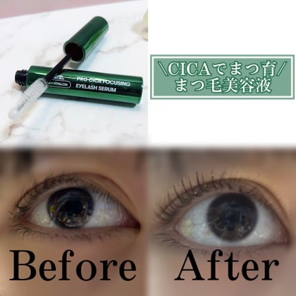 プロCICA フォーカシングアイラッシュセラム/VT/まつげ美容液を使ったクチコミ(1枚目)