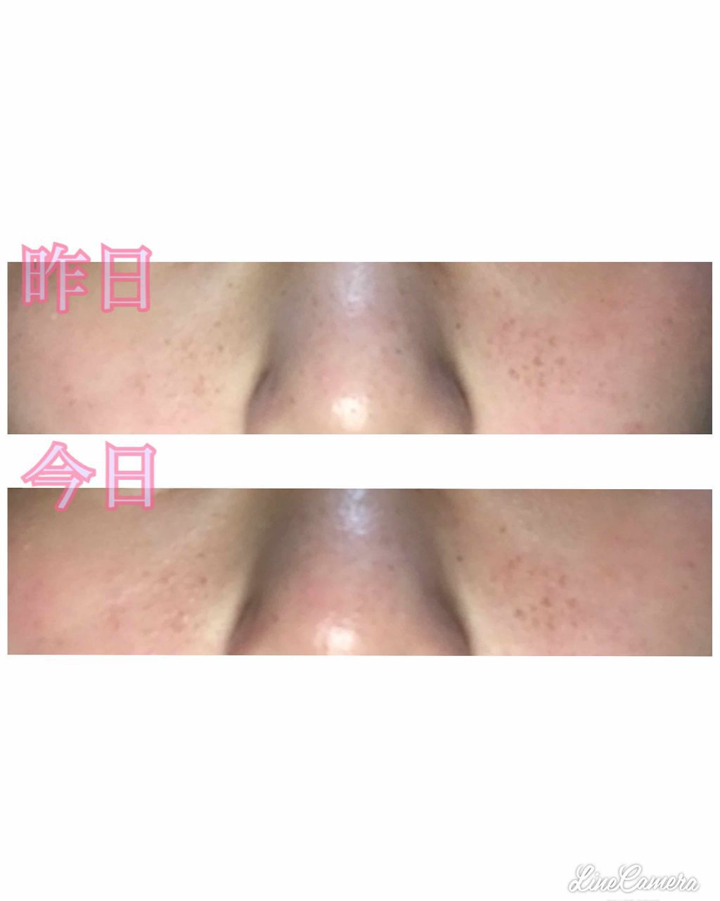 薬用美白 オールインワンジェル/DAISO/オールインワン化粧品を使ったクチコミ（2枚目）