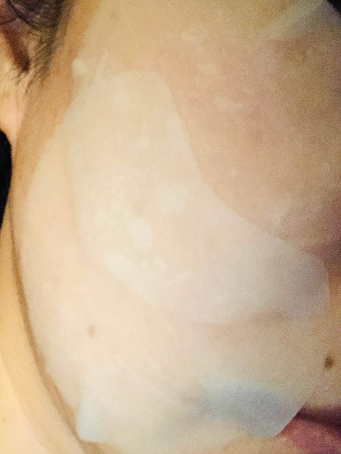 センテラ クイックカーミングパッド/SKIN1004/トナーパッドを使ったクチコミ(3枚目)