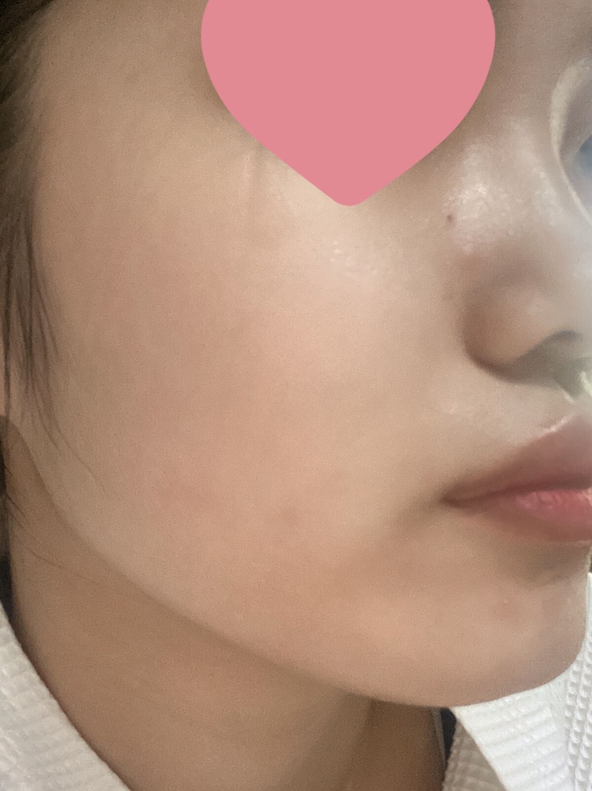 スキンライトセラピーII/Makeon/美顔器・マッサージを使ったクチコミ（2枚目）