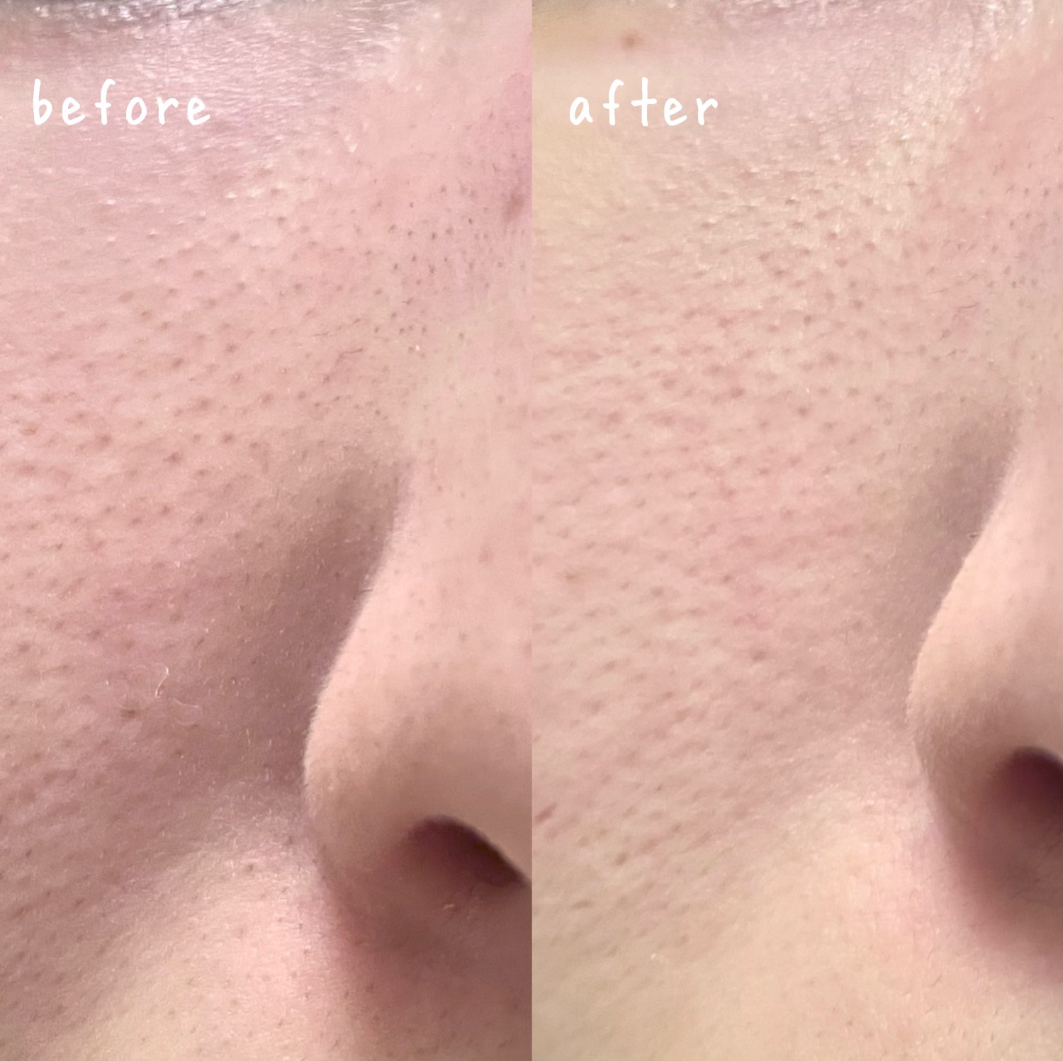 グリーントマトクレイマスククレンザー/FULLY/洗い流すパック・マスクを使ったクチコミ（3枚目）