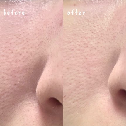 グリーントマトクレイマスククレンザー/FULLY/洗い流すパック・マスクを使ったクチコミ(3枚目)