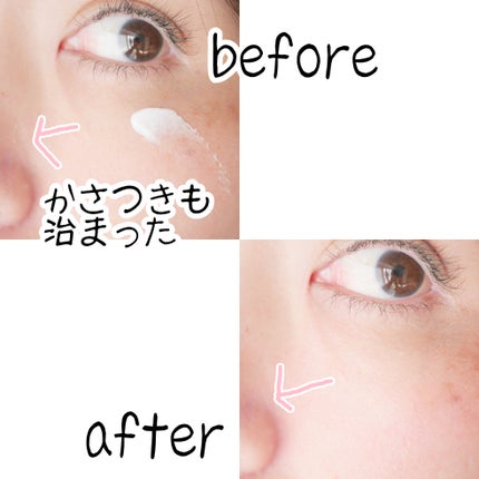 アトバリア365クリーム/AESTURA/フェイスクリームを使ったクチコミ(6枚目)