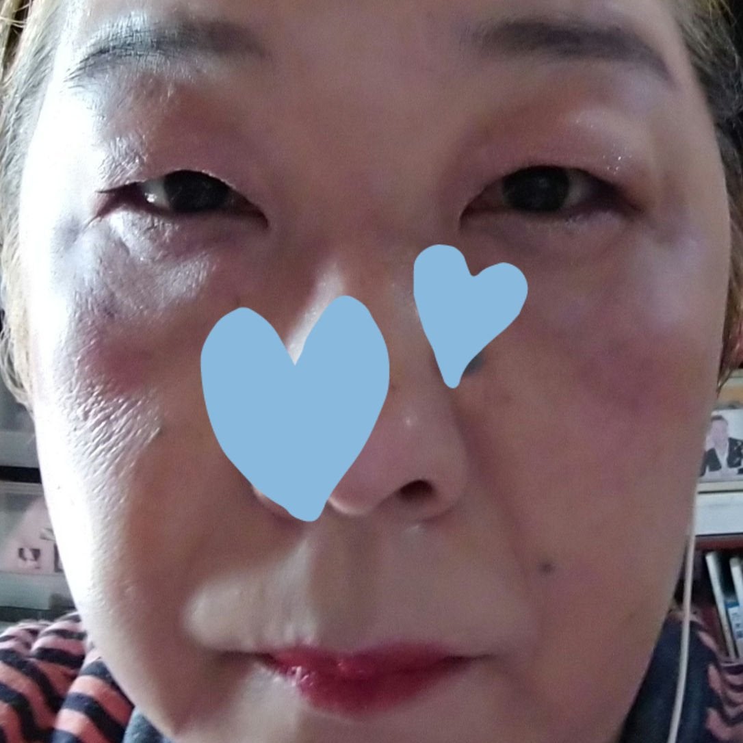 スキニーリッチシャドウ/excel/アイシャドウパレットを使ったクチコミ(3枚目)