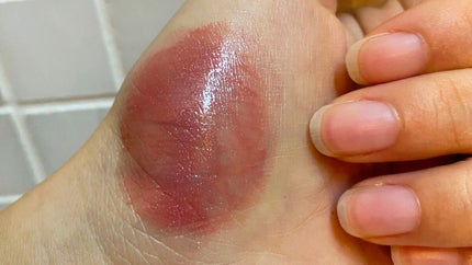 【旧】ディオール アディクト リップ マキシマイザー/Dior/リップグロスを使ったクチコミ(1枚目)