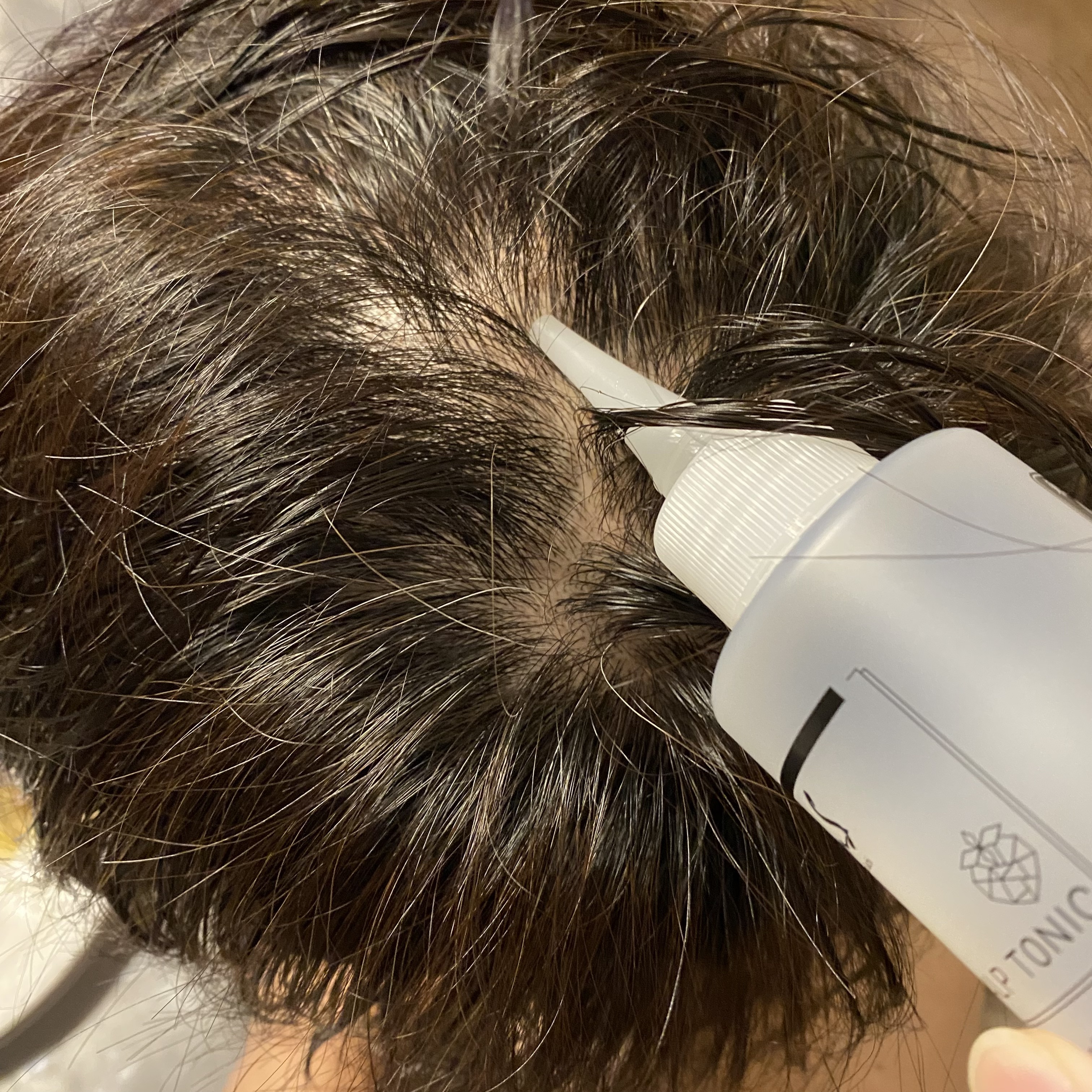 KnS 柿のさち スカルプトニック/マックス/頭皮ローションを使ったクチコミ（3枚目）