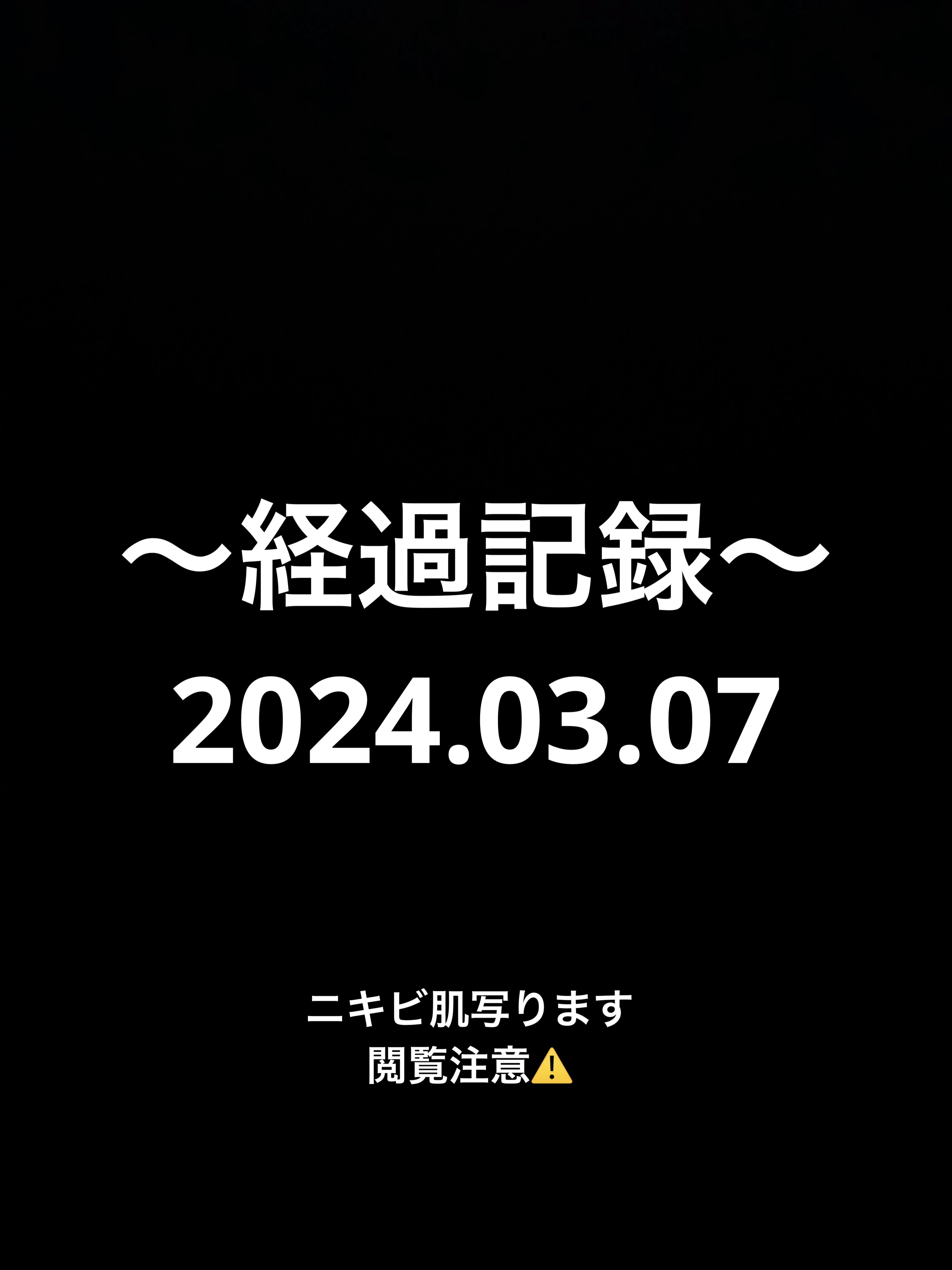 ガラクナイアシン2.0エッセンス/manyo/美容液を使ったクチコミ（1枚目）