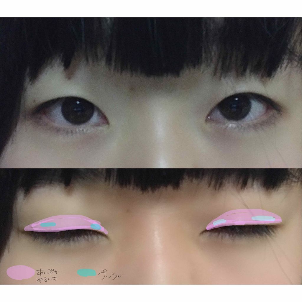 アイトーク/アイトーク/二重まぶた用アイテムを使ったクチコミ（3枚目）