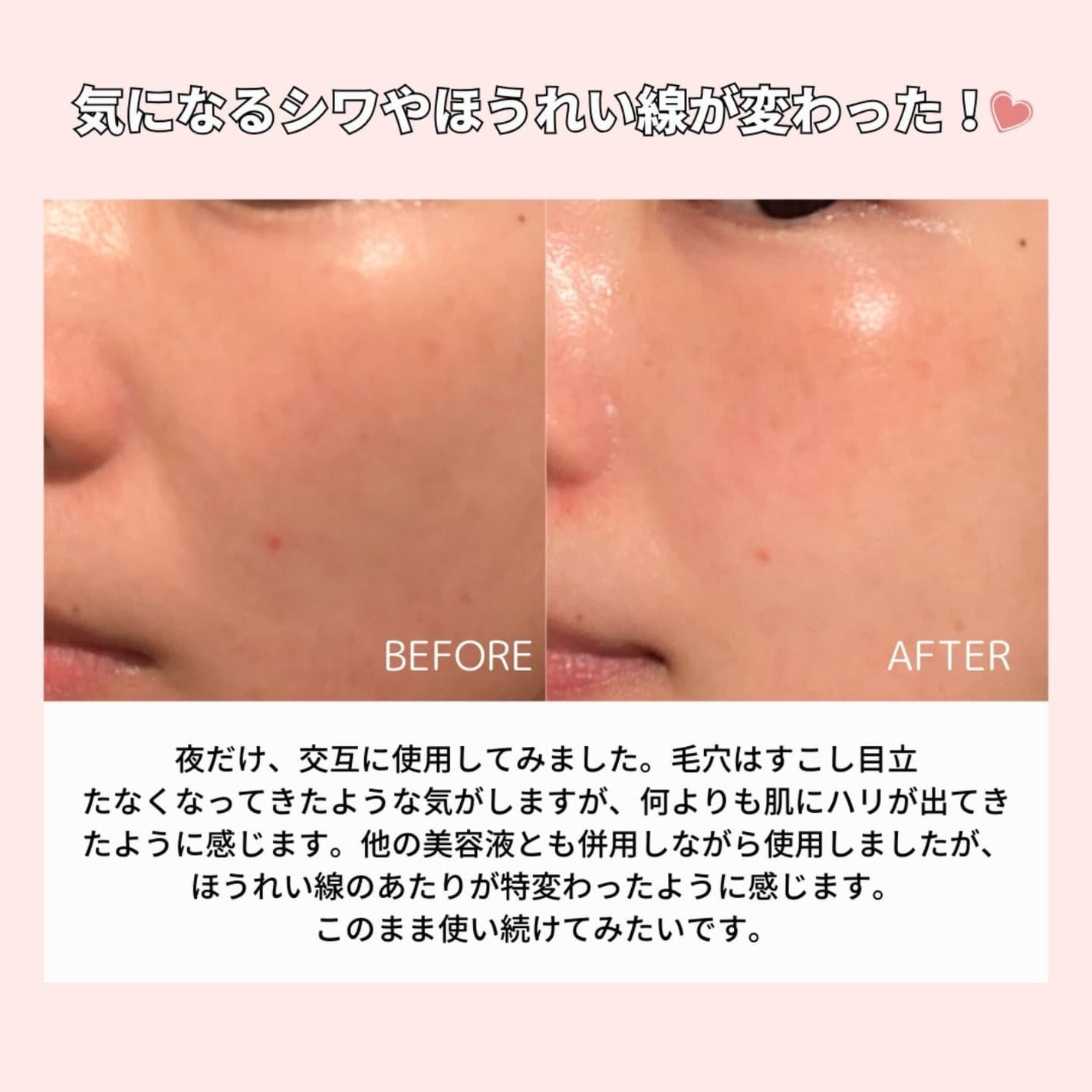 パンテショット675/COSNORI/美容液を使ったクチコミ(6枚目)