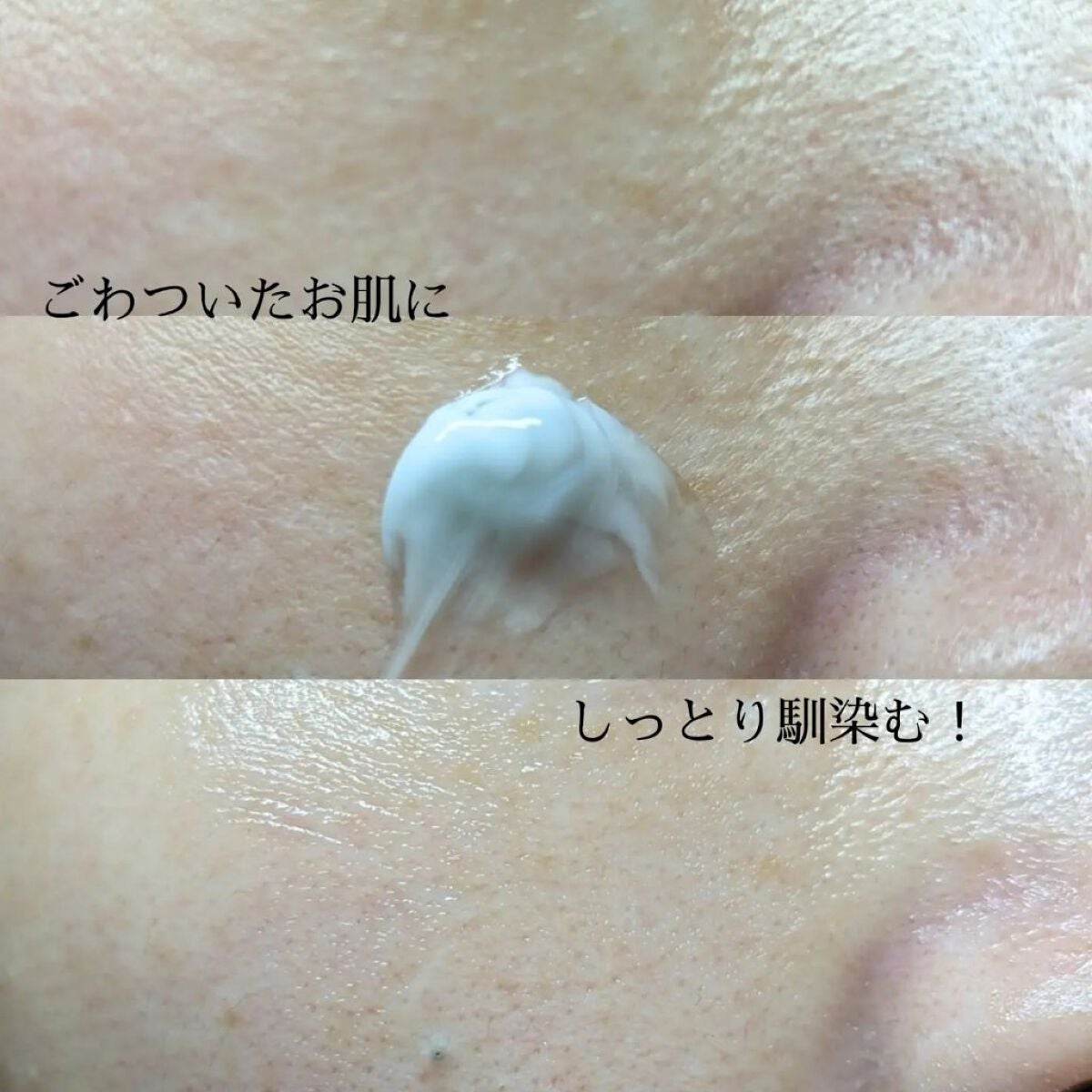 ちま on LIPS 「【開けてびっくり😳】✔メディピールパワーアクアクリ..」(8枚目)