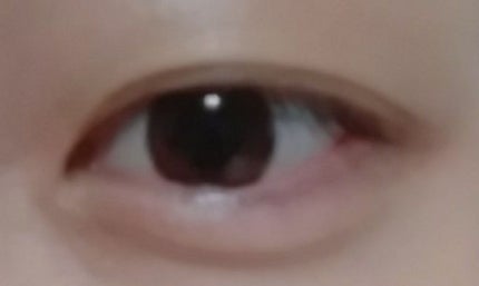 サンテ ボーティエ(医薬品)/参天製薬/その他を使ったクチコミ(2枚目)