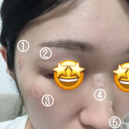 DHC 持続型ビオチン/DHC/美容サプリメントを使ったクチコミ(2枚目)