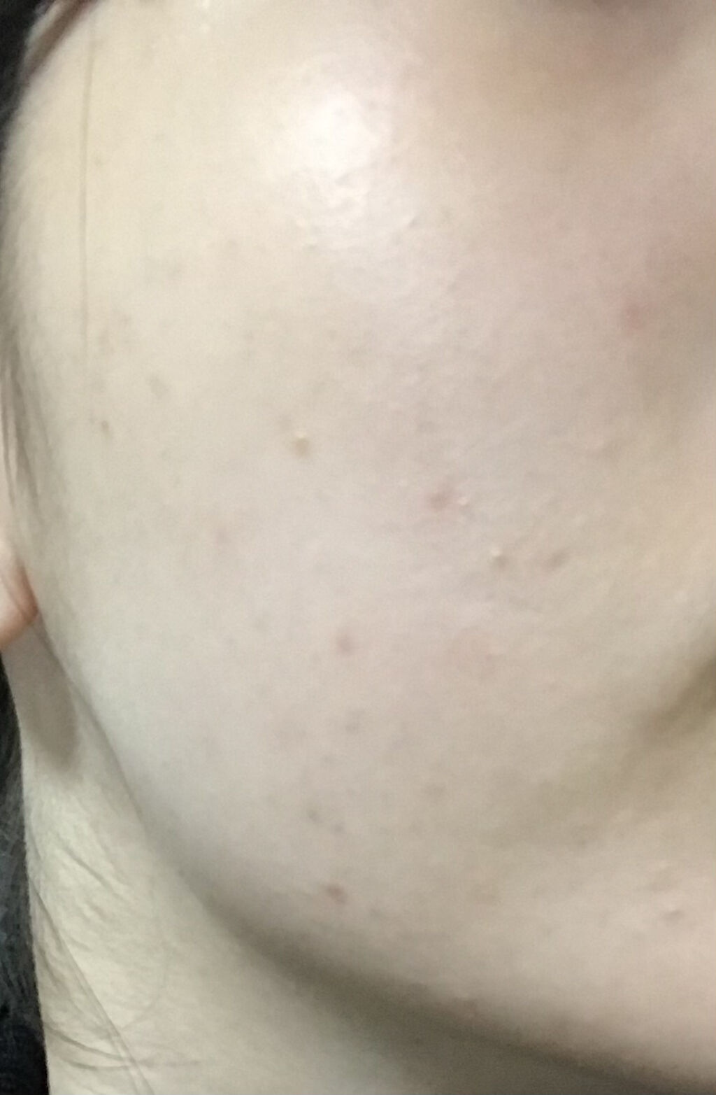 薬用整肌化粧水/肌美精/化粧水を使ったクチコミ（3枚目）