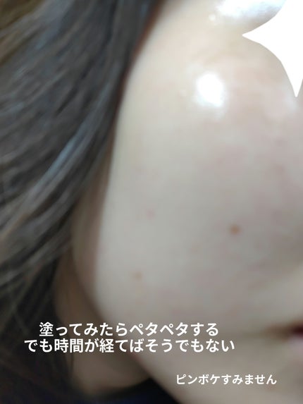 グリーンダーマCICAセラム/ネイチャーリパブリック/美容液を使ったクチコミ(4枚目)