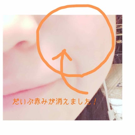 DHC ビタミンCハードカプセル/DHC/美容サプリメントを使ったクチコミ(4枚目)