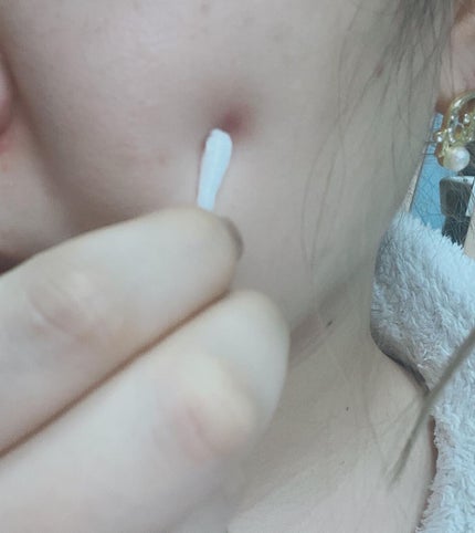 マジックティーツリーオイル/ブラン/フェイスオイルを使ったクチコミ(2枚目)