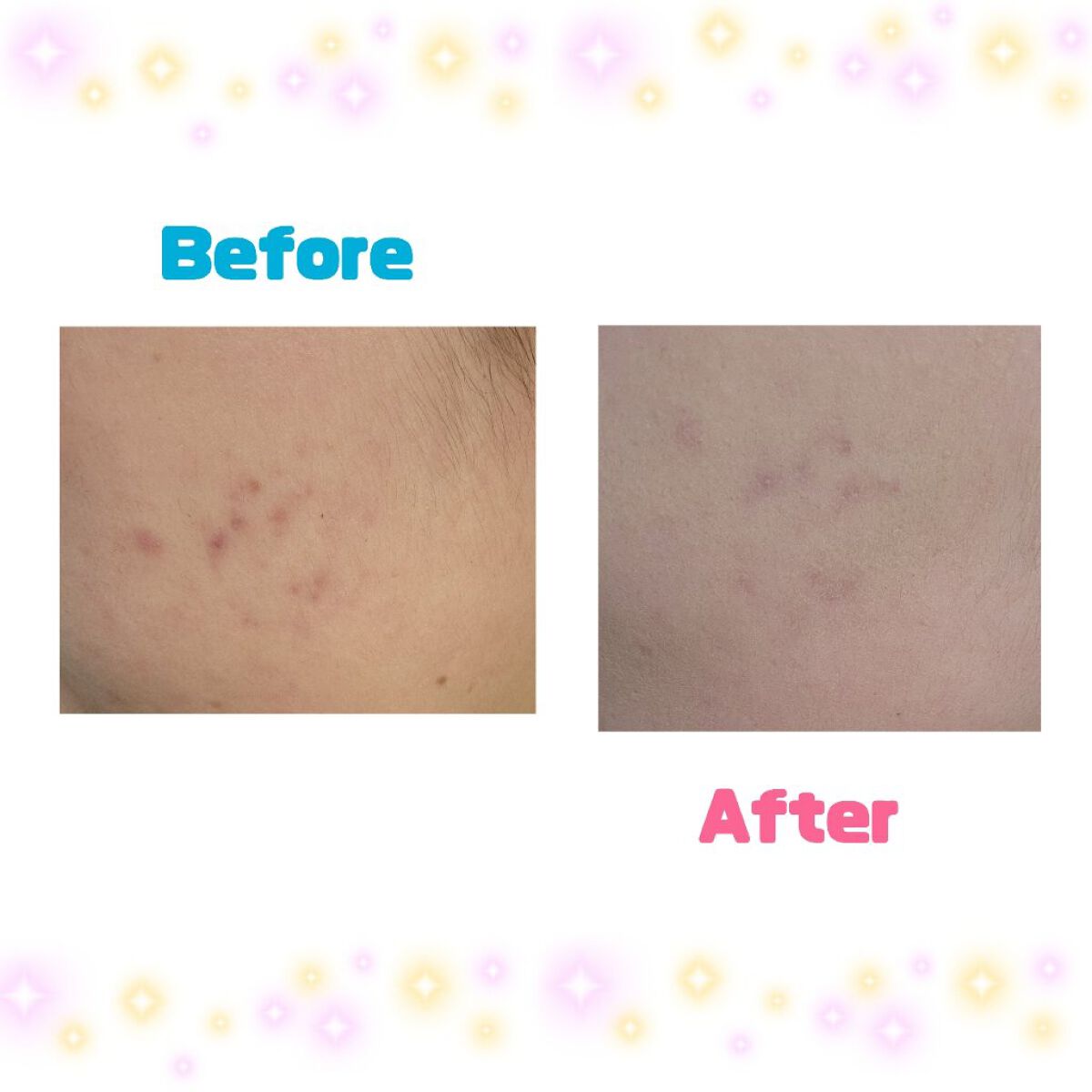 カバーパーフェクション チップコンシーラー/the SAEM/リキッドコンシーラーを使ったクチコミ（3枚目）