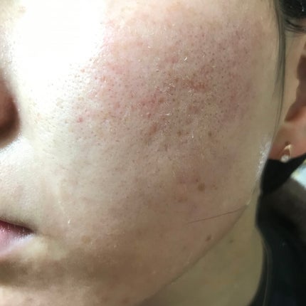 N10+Z1フェイスセラム /The Ordinary/美容液を使ったクチコミ(2枚目)