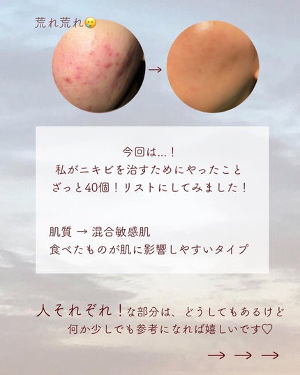 yuyuð¶èèãäœè³ªã®æ£çŽã¬ãã¥ãŒ on LIPS ãããããæ²æ»
ã®ããã«ð¥ããã¹ãããšãâŒâ¢â¢âââ¢â¢âŒâ¢â¢âââ¢..ãïŒ2æç®ïŒ
