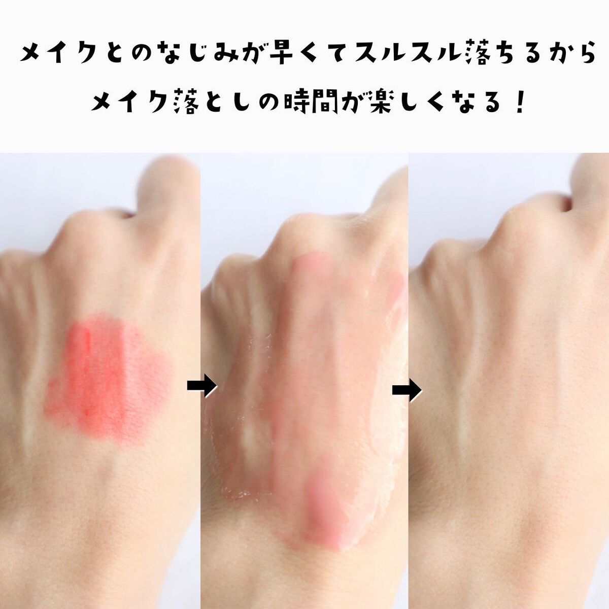 夢みるバーム アクネクリアモイスチャー/ロゼット/クレンジングバームを使ったクチコミ（3枚目）
