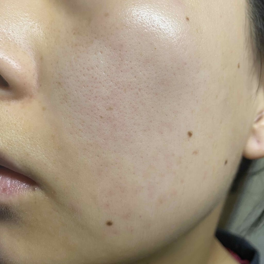 fresh_lips_rmq on LIPS 「5/10オバジ使い始めた..」(2枚目)