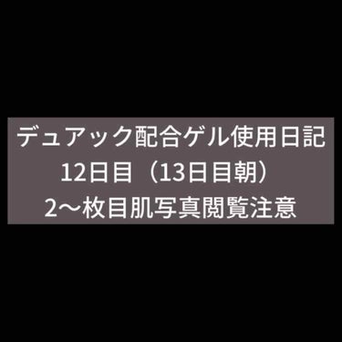 デュアック配合ゲル/ポーラファルマ/その他を使ったクチコミ（1枚目）