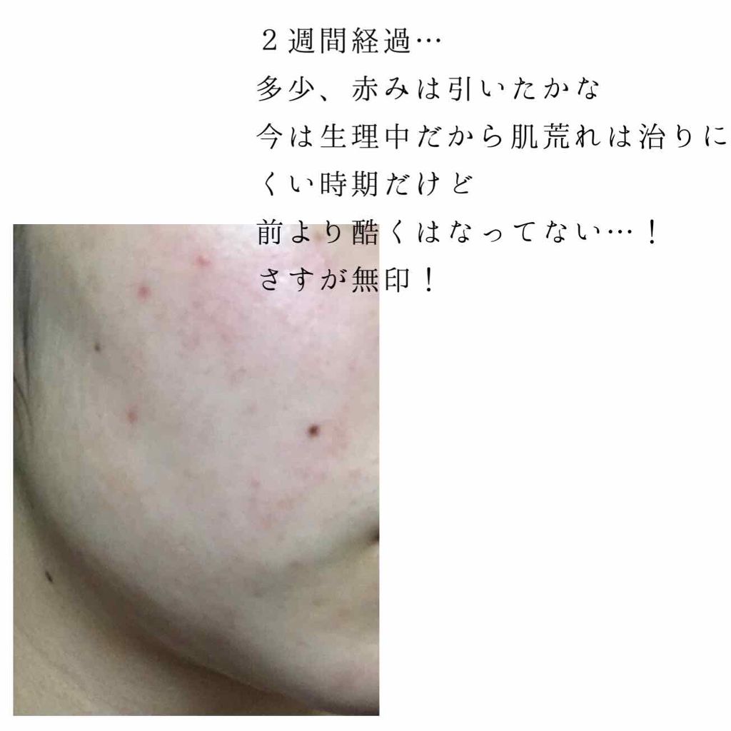 化粧水・敏感肌用・しっとりタイプ/無印良品/化粧水を使ったクチコミ（2枚目）