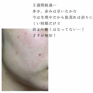 化粧水・敏感肌用・しっとりタイプ/無印良品/化粧水を使ったクチコミ（2枚目）