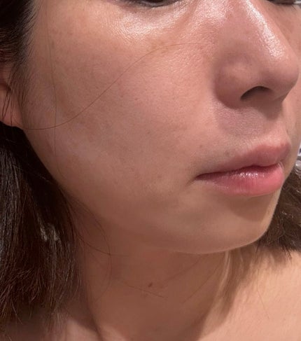 グローブースト マルチV トナー/ByUR/化粧水を使ったクチコミ(8枚目)