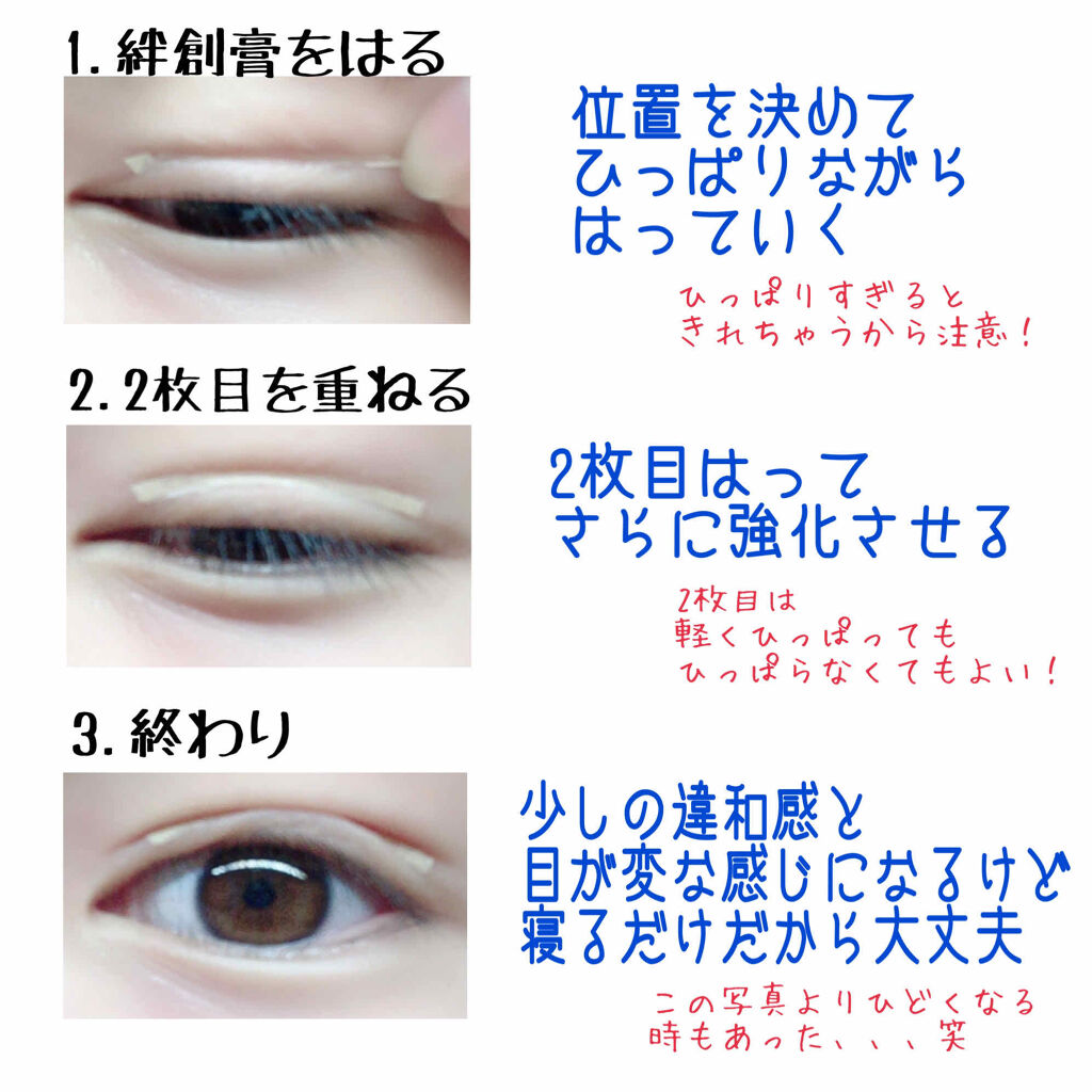 救急ばんそうこう/ドン・キホーテ/その他を使ったクチコミ（2枚目）