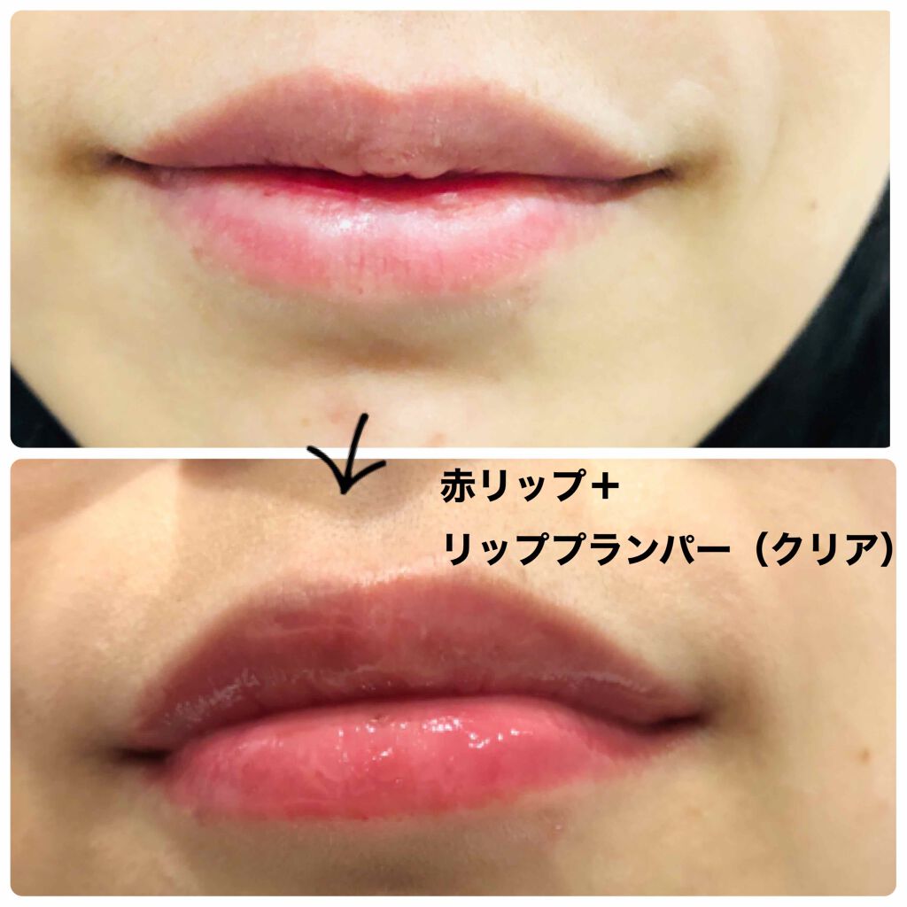 リッププランパー/メークソリューション/リッププランパーを使ったクチコミ(3枚目)